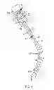 Fig. 02 - SURGICAL INSTRUMENT SHAFT