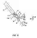 Fig. 06 - Autofocus and/or autoscaling in telesurgery