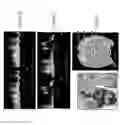 Fig. 07 - SURGICAL GUIDING AND POSITION SYSTEM