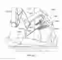 Fig. 34 - Surgical system entry guide