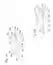 Fig. 43 - DEVICE FOR REMOVING ACROCHORDONS