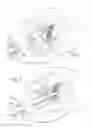 Fig. 02 - Method and apparatus for circulatory valve repair