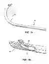 Fig. 03 - Suture passing devices and methods
