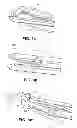 Fig. 04 - Suture passing devices and methods