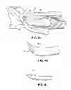 Fig. 05 - Suture passing devices and methods