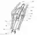Fig. 01 - Devices and methods for percutaneous tissue removal