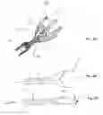 Fig. 03 - Devices and methods for percutaneous tissue removal