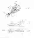 Fig. 04 - Devices and methods for percutaneous tissue removal