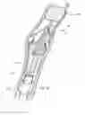 Fig. 16 - Devices and methods for percutaneous tissue removal