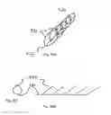 Fig. 24 - Devices and methods for percutaneous tissue removal