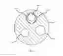 Fig. 04 - Expandable support structure for delivery through a working channel