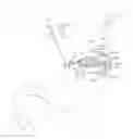 Fig. 01 - Methods and devices for deploying and releasing a temporary implant within the body