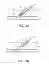Fig. 04 - Apparatus and methods for facilitating hemostasis within a vascular puncture