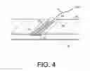 Fig. 05 - Apparatus and methods for facilitating hemostasis within a vascular puncture