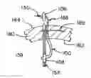 Fig. 01 - Apparatus and method for repairing tissue