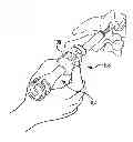 Fig. 01 - VERTEBRAL JOINT IMPLANTS AND DELIVERY TOOLS