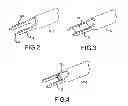 Fig. 04 - VERTEBRAL JOINT IMPLANTS AND DELIVERY TOOLS