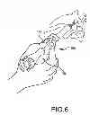 Fig. 06 - VERTEBRAL JOINT IMPLANTS AND DELIVERY TOOLS