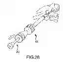 Fig. 22 - VERTEBRAL JOINT IMPLANTS AND DELIVERY TOOLS