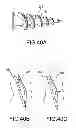 Fig. 30 - VERTEBRAL JOINT IMPLANTS AND DELIVERY TOOLS