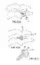Fig. 32 - VERTEBRAL JOINT IMPLANTS AND DELIVERY TOOLS