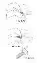 Fig. 34 - VERTEBRAL JOINT IMPLANTS AND DELIVERY TOOLS