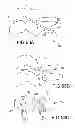 Fig. 44 - VERTEBRAL JOINT IMPLANTS AND DELIVERY TOOLS