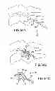 Fig. 45 - VERTEBRAL JOINT IMPLANTS AND DELIVERY TOOLS