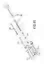 Fig. 77 - VERTEBRAL JOINT IMPLANTS AND DELIVERY TOOLS