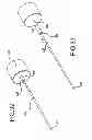 Fig. 82 - VERTEBRAL JOINT IMPLANTS AND DELIVERY TOOLS