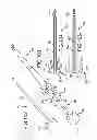 Fig. 87 - VERTEBRAL JOINT IMPLANTS AND DELIVERY TOOLS