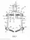 Fig. 02 - Spinal stabilization system