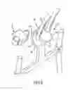 Fig. 09 - Spinal stabilization system
