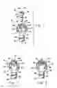 Fig. 02 - Orthopedic anchor assembly