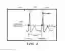 Fig. 06 - Systems and methods for sensing vector selection in an implantable medical device