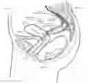 Fig. 01 - Devices and methods for stimulating nerves