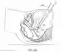 Fig. 49 - Devices and methods for stimulating nerves