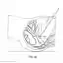 Fig. 50 - Devices and methods for stimulating nerves
