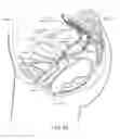Fig. 60 - Devices and methods for stimulating nerves
