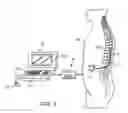 Fig. 06 - System and method for connecting devices to a neurostimulator