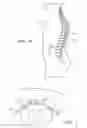Fig. 06 - Short duration pre-pulsing to reduce stimulation-evoked side-effetcs