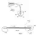 Fig. 04 - Electromagnetic shield for a passive electronic component in an active medical device implantable lead