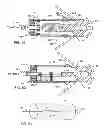 Fig. 25 - Electromagnetic shield for a passive electronic component in an active medical device implantable lead