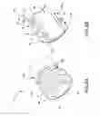 Fig. 07 - Bipolar active cardiac electrical lead
