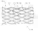 Fig. 01 - Gradually self-expanding stent