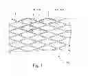 Fig. 02 - Gradually self-expanding stent
