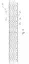 Fig. 07 - Gradually self-expanding stent