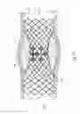 Fig. 09 - Gradually self-expanding stent
