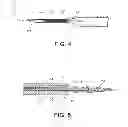 Fig. 04 - Apparatus and method for loading and delivering a stent using a suture retaining mechanism