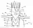 Fig. 01 - Prosthesis having pivoting fenestration